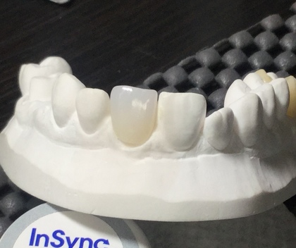 AG Zolid FX Zirconia